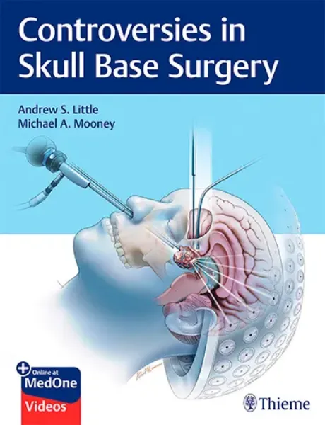 Imagem de Controversies in Skull Base Surgery