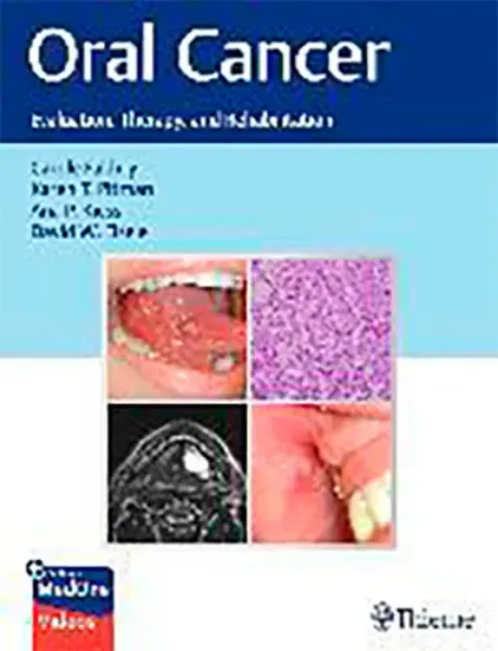 Imagem de Oral Cancer: Evaluation, Therapy and Rehabilitation