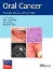 Imagem de Oral Cancer: Evaluation, Therapy and Rehabilitation
