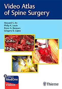 Imagem de Video Atlas of Spine Surgery