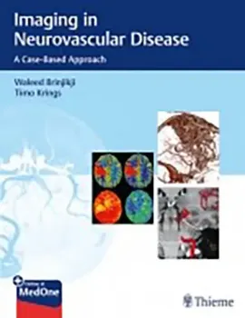 Imagem de Imaging in Neurovascular Disease: A Case-Based Approach
