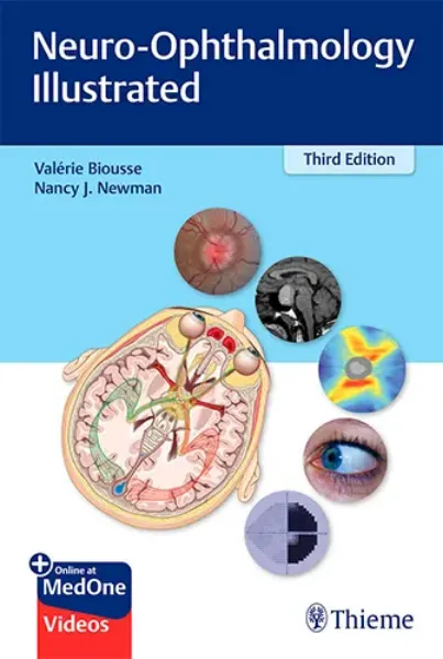 Imagem de Neuro-Ophthalmology Illustrated
