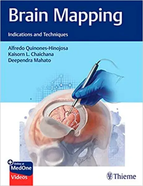 Imagem de Brain Mapping: Indications and Techniques