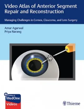 Imagem de Video Atlas of Anterior Segment Repair and Reconstruction: Managing Challenges in Cornea, Glaucoma, and Lens Surgery