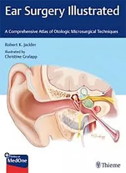 Imagem de Ear Surgery Illustrated: A Comprehensive Atlas of Otologic Microsurgical Techniques