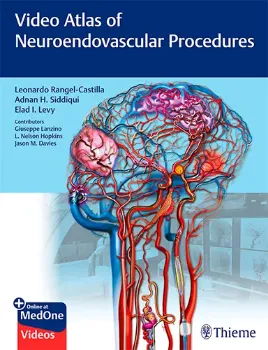 Picture of Book Video Atlas of Neuroendovascular Procedures