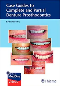 Imagem de Case Guides to Complete and Partial Denture Prosthodontics