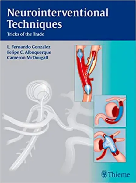 Imagem de Neurointerventional Techniques: Tricks of the Trade