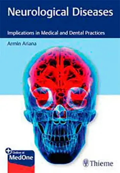 Picture of Book Neurological Diseases: Implications in Medical and Dental Practices