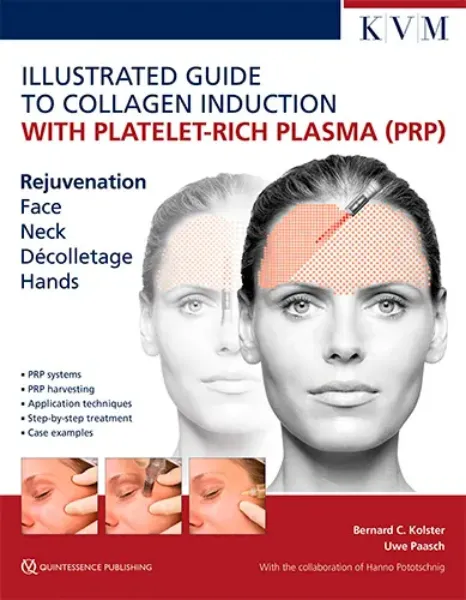 Imagem de Illustrated Guide to Collagen Induction with Platelet-Rich Plasma (PRP) Rejuvenation Face | Neck | Décolleté | Hands
