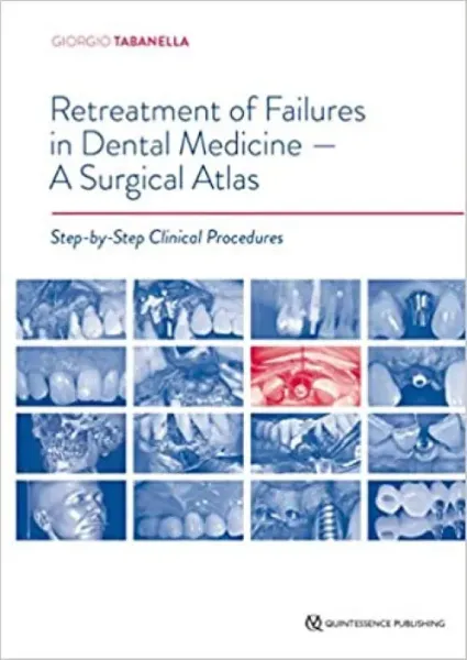 Imagem de Retreatment of Failures in Dental Medicine - A Surgical Atlas Step-by-Step Clinical Procedures
