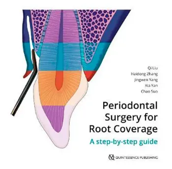 Imagem de Periodontal Surgery for Root Coverage: A step-by-step guide