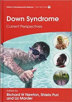 Imagem de Down Syndrome: Current Perspectives