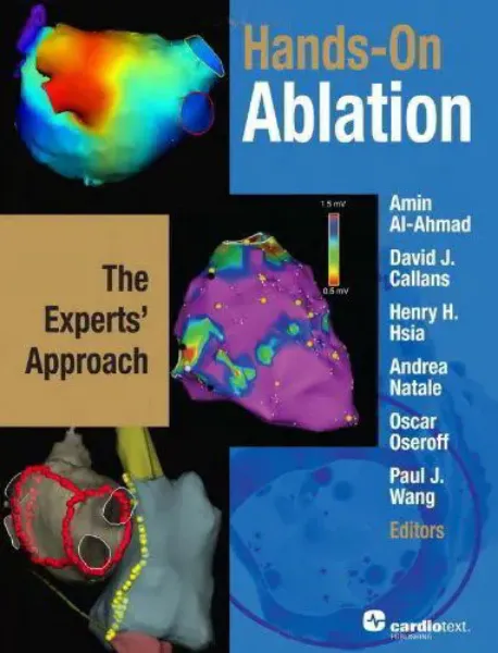 Imagem de Hands-on Ablation: The Experts Approach
