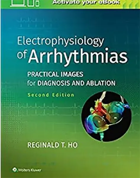Imagem de Electrophysiology of Arrhythmias: Practical Images for Diagnosis and Ablation