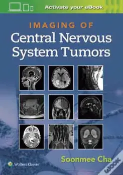 Picture of Book Imaging of Central Nervous System Tumors