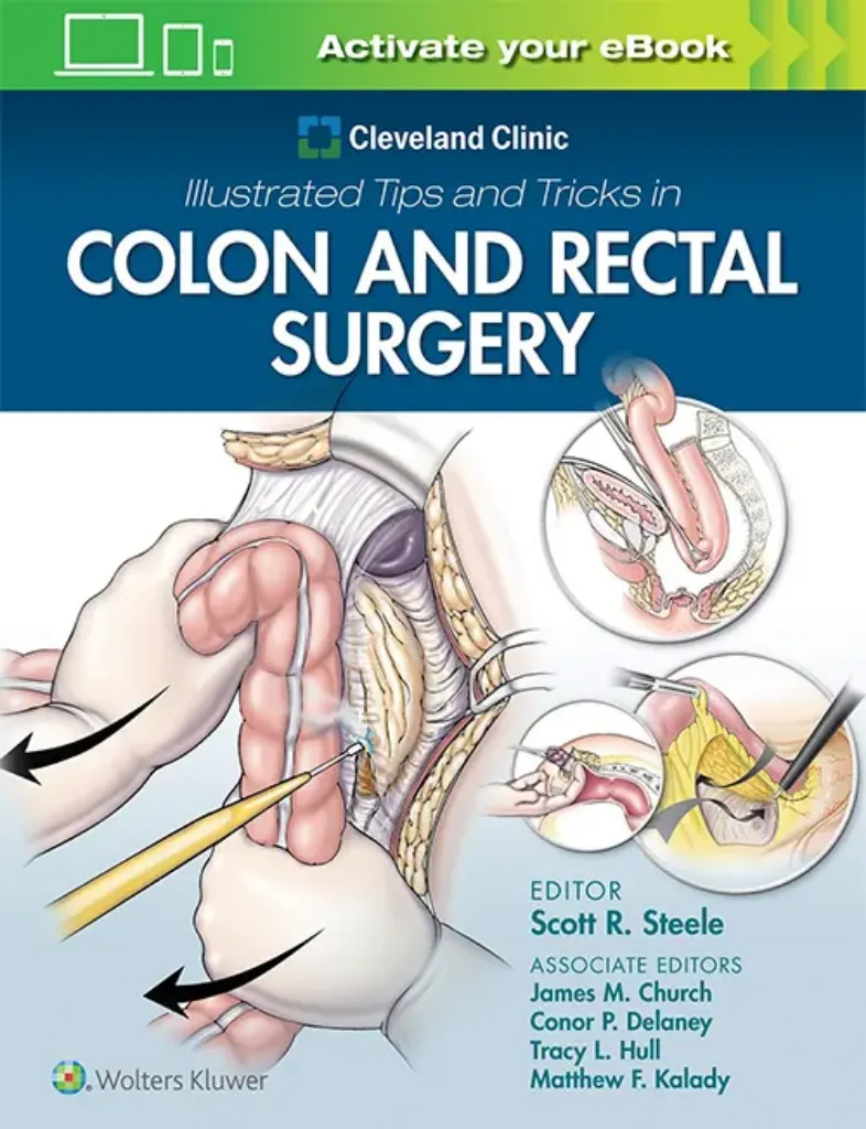 Imagem de Cleveland Clinic Illustrated Tips and Tricks in Colon and Rectal Surgery