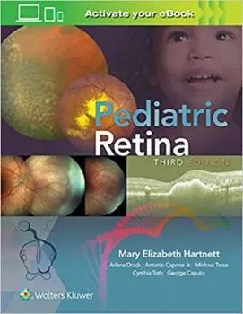 Imagem de Pediatric Retina