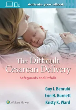 Picture of Book The Difficult Cesarean Delivery: Safeguards and Pitfalls
