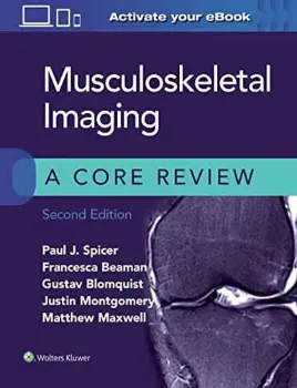 Imagem de Musculoskeletal Imaging: A Core Review