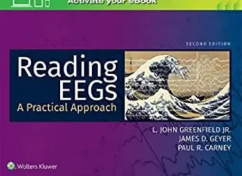 Imagem de Reading EEGs: A Practical Approach