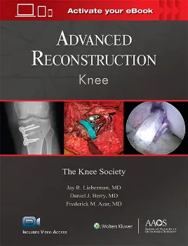 Imagem de Advanced Reconstruction: Knee Print + Ebook with Multimedia