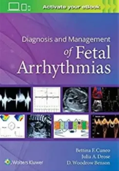 Imagem de Diagnosis and Management of Fetal Arrhythmias