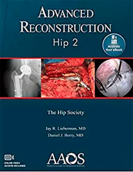 Imagem de Advanced Reconstruction: Hip 2 Print + Ebook with Multimedia
