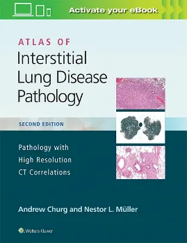 Imagem de Atlas of Interstitial Lung Disease Pathology