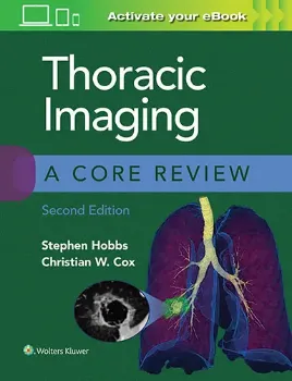Imagem de Thoracic Imaging: A Core Review