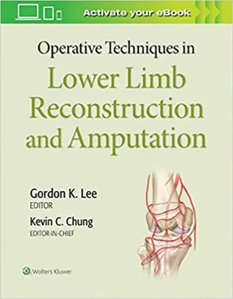 Imagem de Operative Techniques in Lower Limb Reconstruction and Amputation