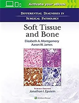 Imagem de Differential Diagnoses in Surgical Pathology: Soft Tissue and Bone
