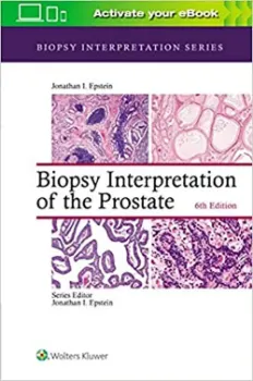 Imagem de Biopsy Interpretation of the Prostate