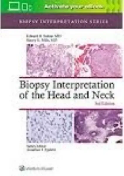 Imagem de Biopsy Interpretation of the Head and Neck