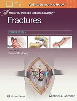 Imagem de Master Techniques in Orthopaedic Surgery: Fractures