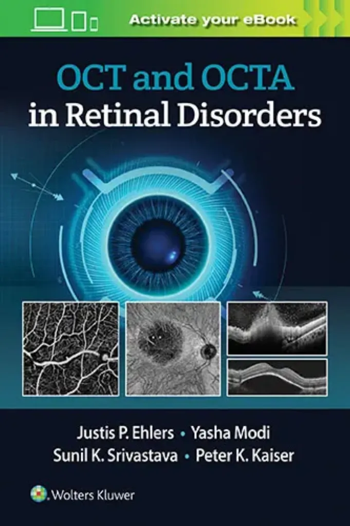 Imagem de OCT and OCTA in Retinal Disorders