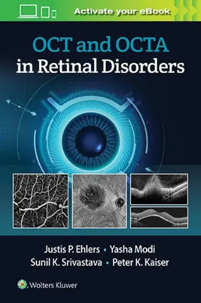 Imagem de OCT and OCTA in Retinal Disorders