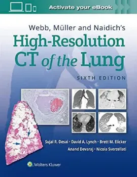 Imagem de Webb, Müller and Naidich's High-Resolution CT of the Lung