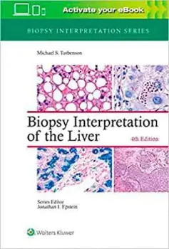 Picture of Book Biopsy Interpretation of the Liver