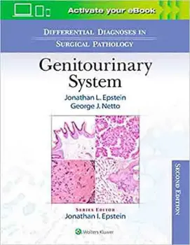 Imagem de Differential Diagnoses in Surgical Pathology: Genitourinary System