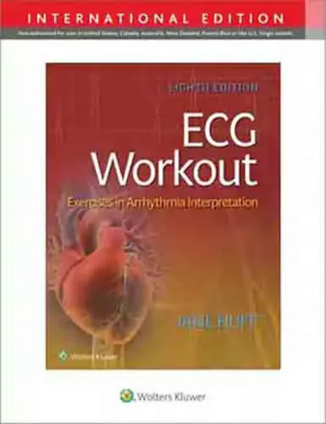 Imagem de ECG Workout: Exercises in Arrythmia Interpretation
