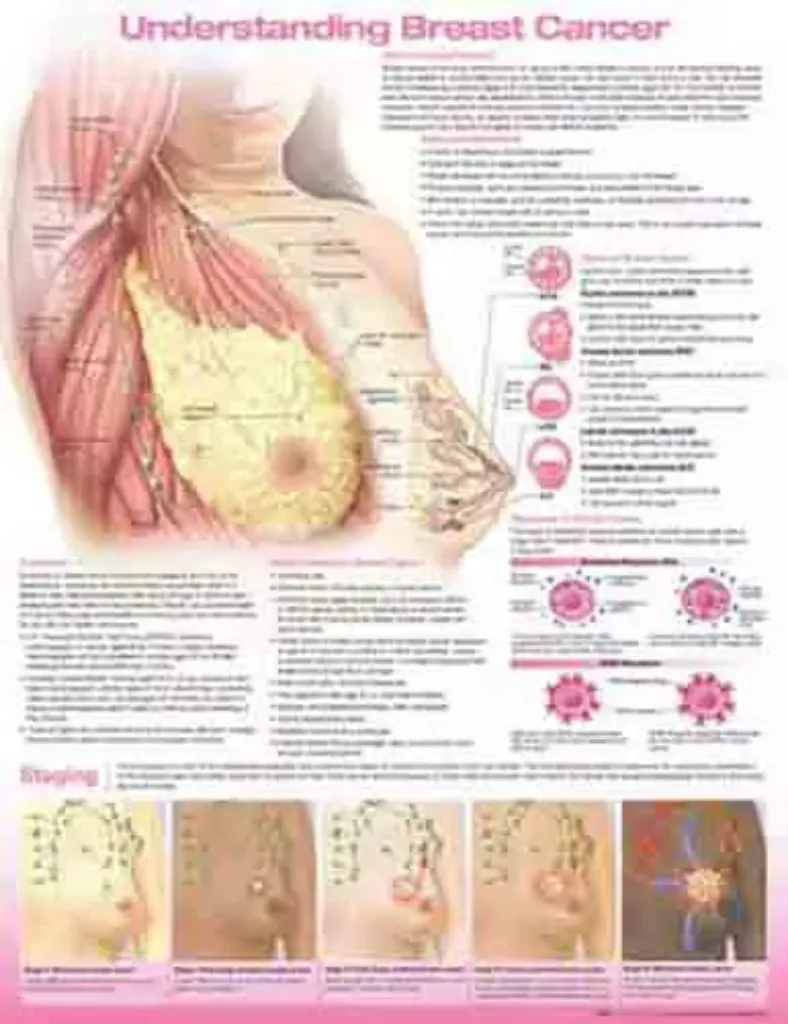Imagem de Understanding Breast Cancer Anatomical Chart