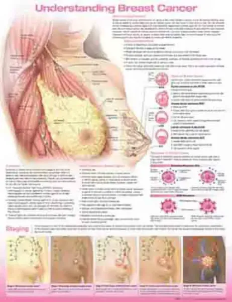 Imagem de Understanding Breast Cancer Anatomical Chart