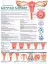 Picture of Book Understanding Cervical Cancer Anatomical Chart
