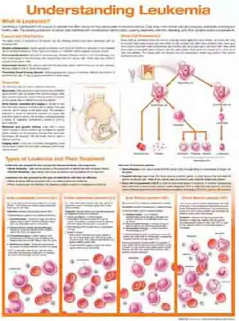 Imagem de Understanding Leukemia Anatomical Chart