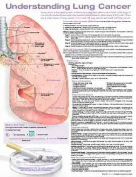 Picture of Book Understanding Lung Cancer Anatomical Chart