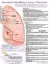 Picture of Book Understanding Lung Cancer Anatomical Chart