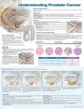 Picture of Book Understanding Prostate Cancer Anatomical Chart