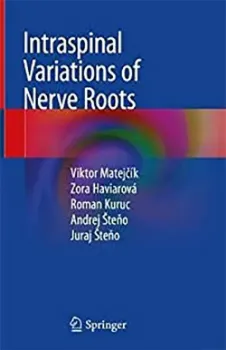 Imagem de Intraspinal Variations of Nerve Roots