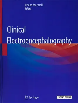 Imagem de Clinical Electroencephalography Springer
